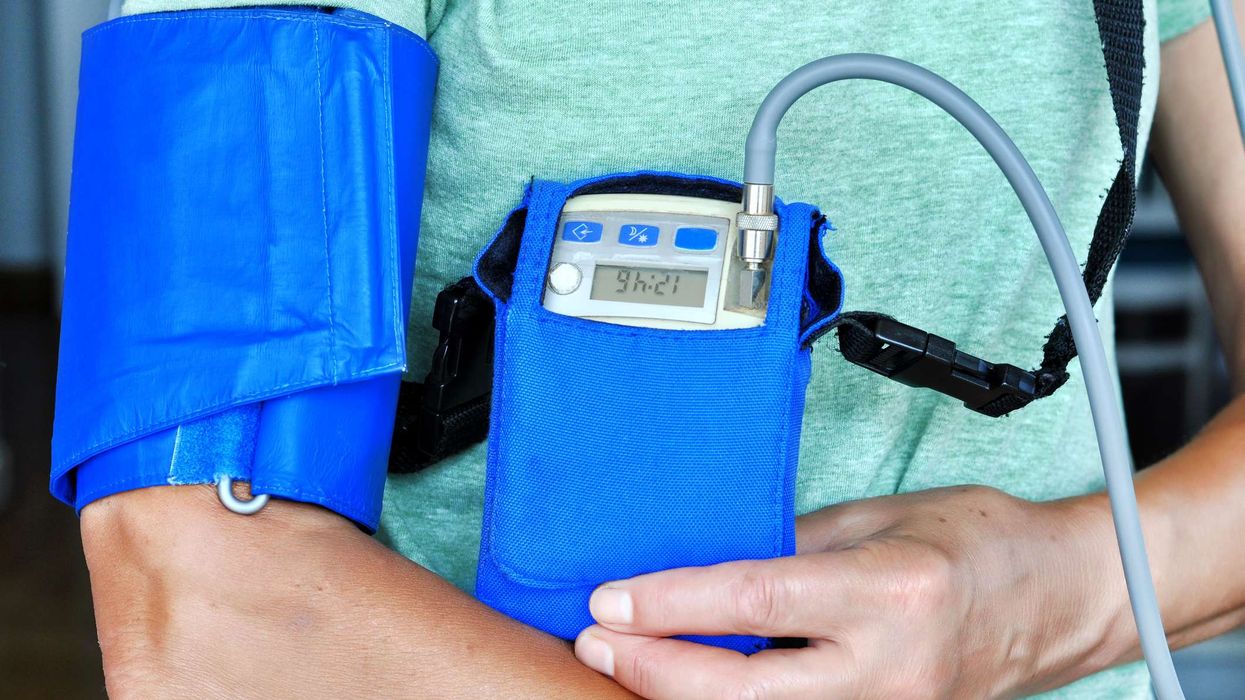 ABPM Pharmacy First bundling requirement put on hold