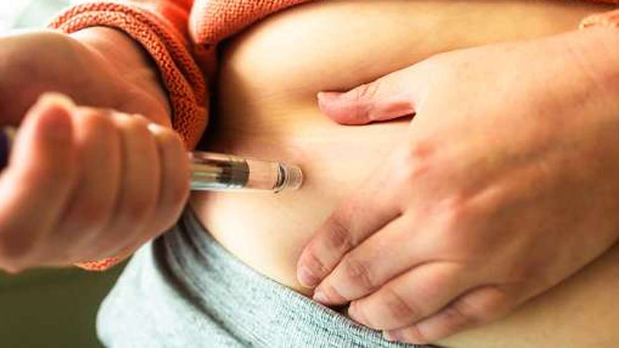 ASA restricts social media ads for weight-loss drugs through affiliate link