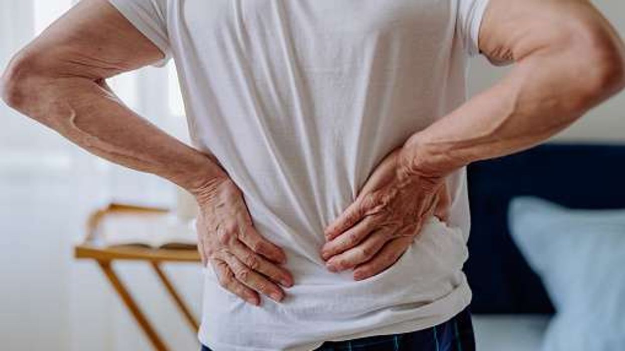 MP appeals for donations to help the National Axial Spondyloarthritis Society