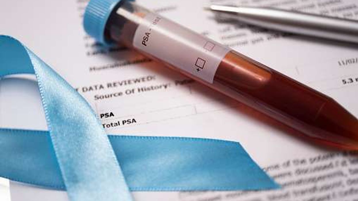 UK experts reject routine prostate cancer screening for most men