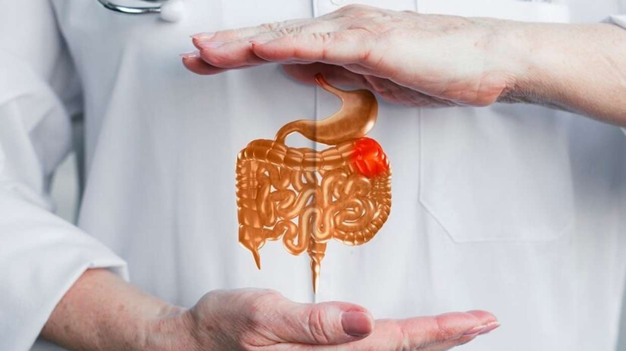 CPPE learning programme to help pharmacy professionals spot early bowel cancer cases