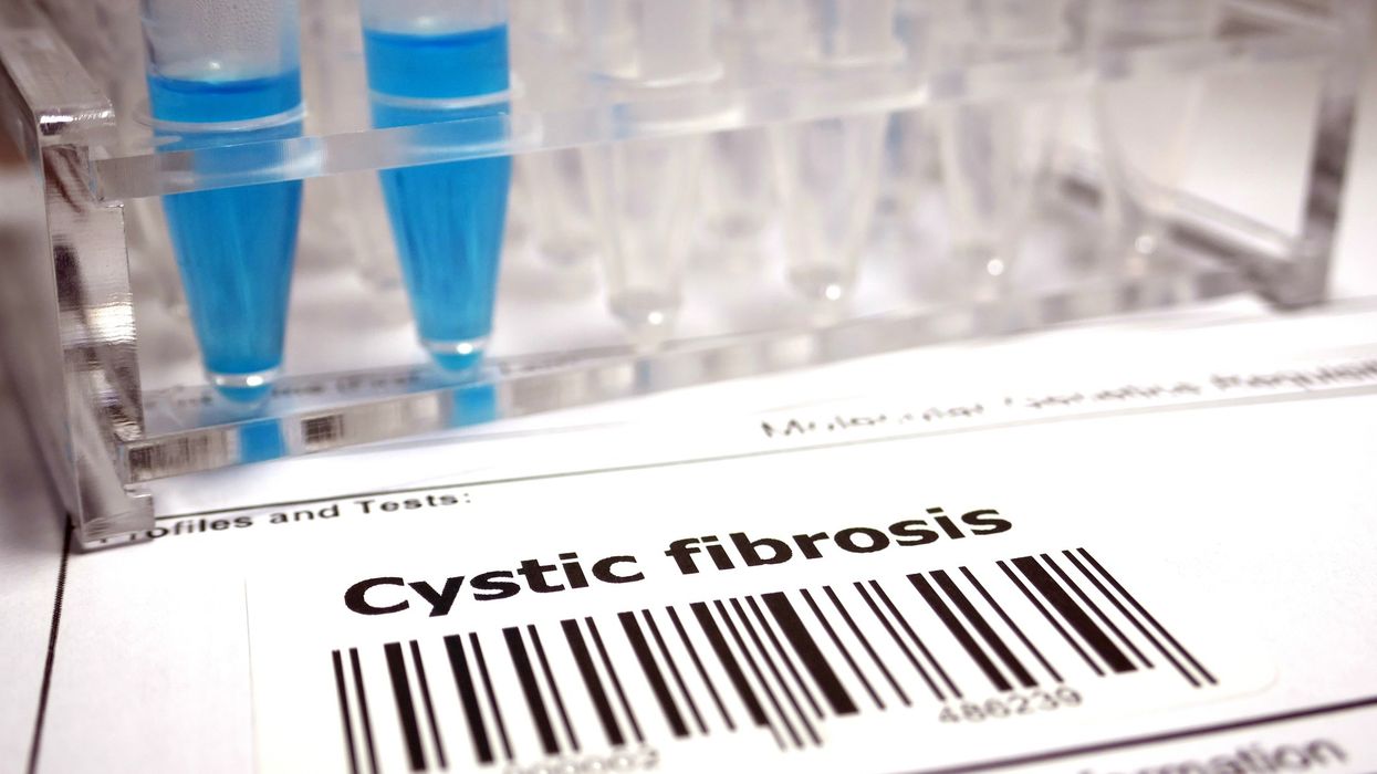 Cystic fibrosis drug Alyftrek