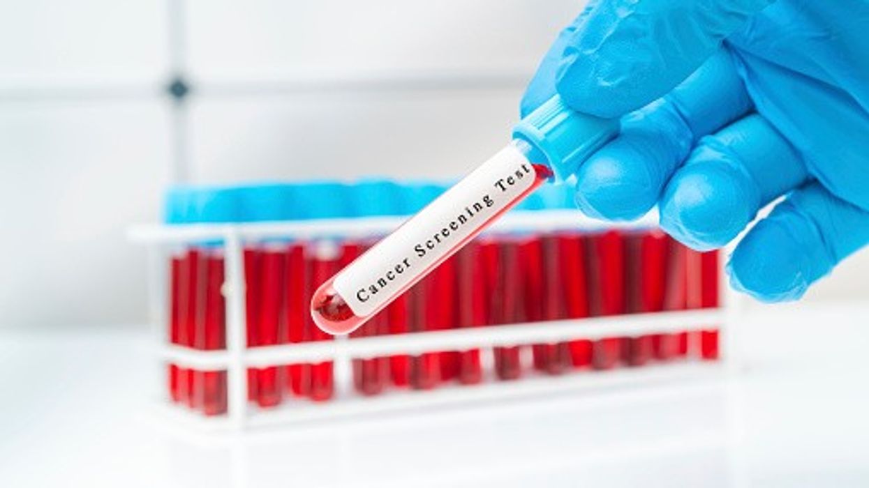 Early cancer diagnosis in England has reached its highest level ever.