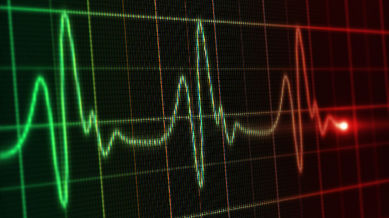 ePatch at-home heart monitors