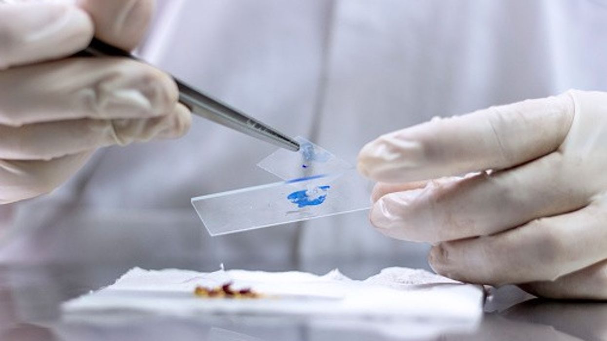 fungal test for fatal infections