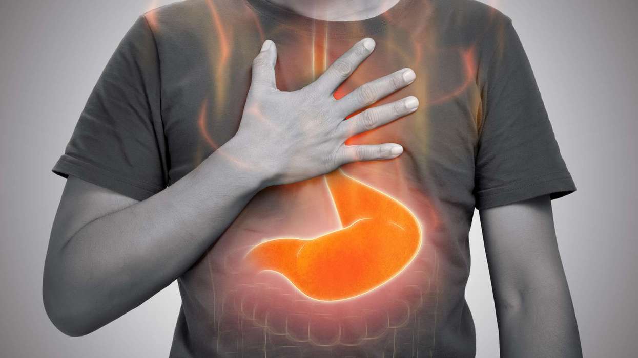 Heartburn sponge test launches in East Midlands pharmacies