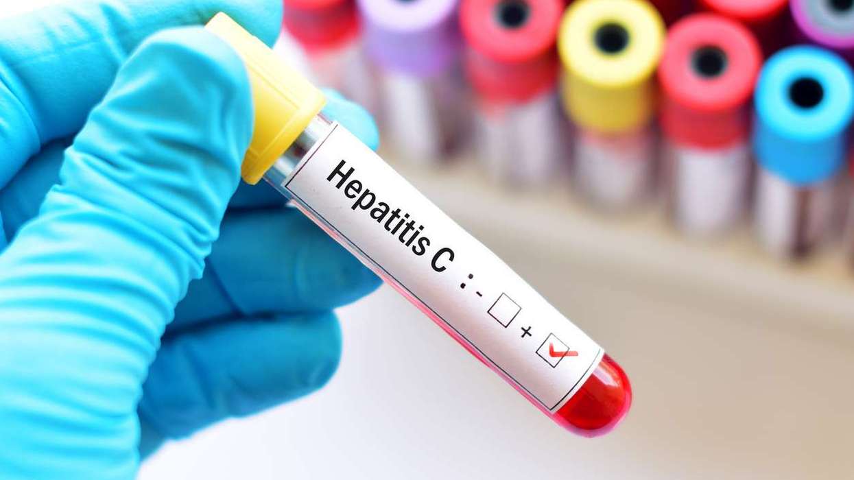Hepatitis C cases drop 61% with improved testing