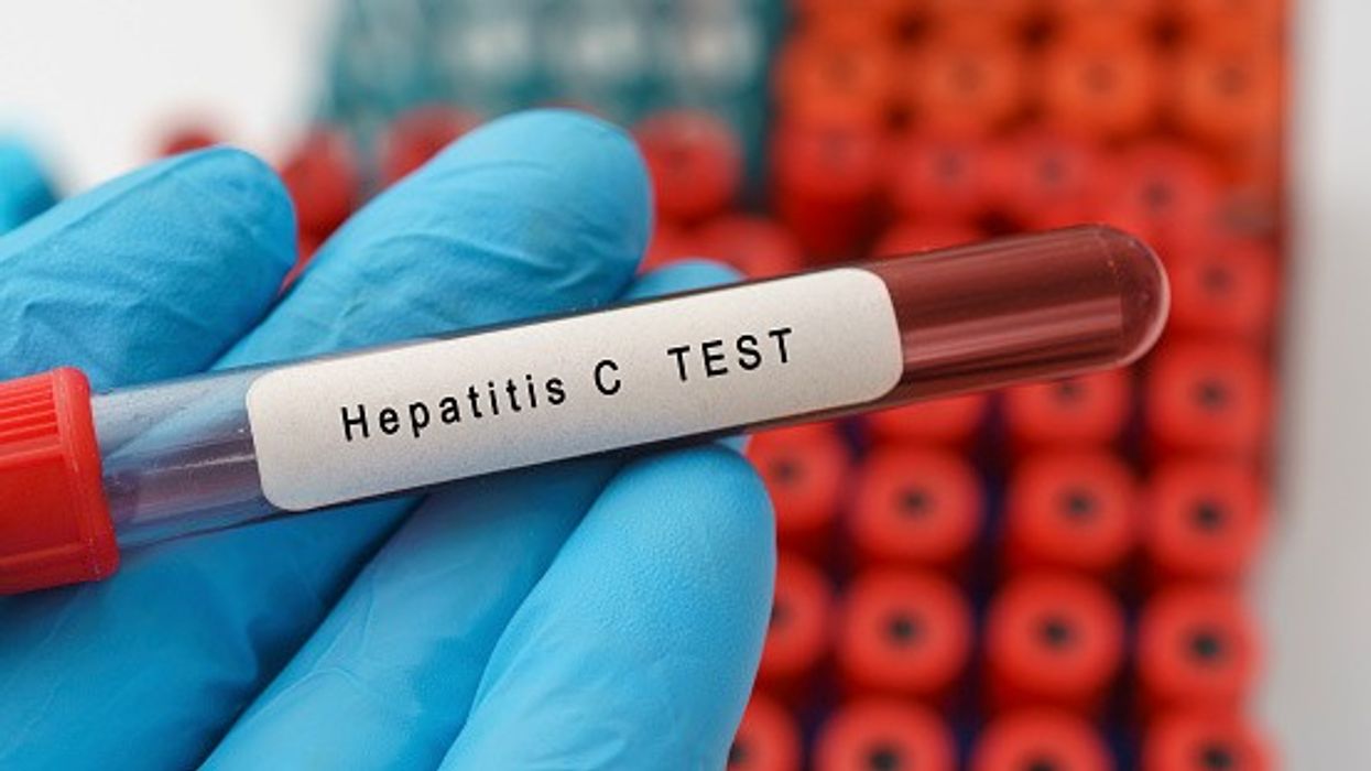 hepatitis C test UK