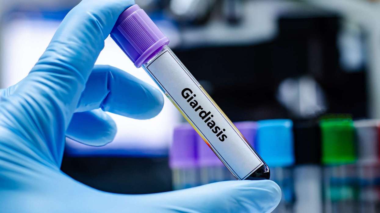 Highest number of Giardia cases reported since 2016: UKHSA