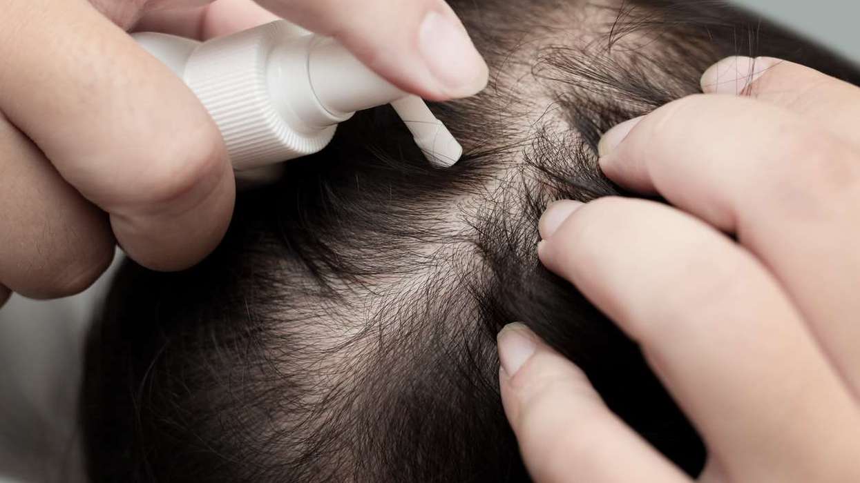 Illegal hair-loss drug seizures rise nearly eight-fold in a year