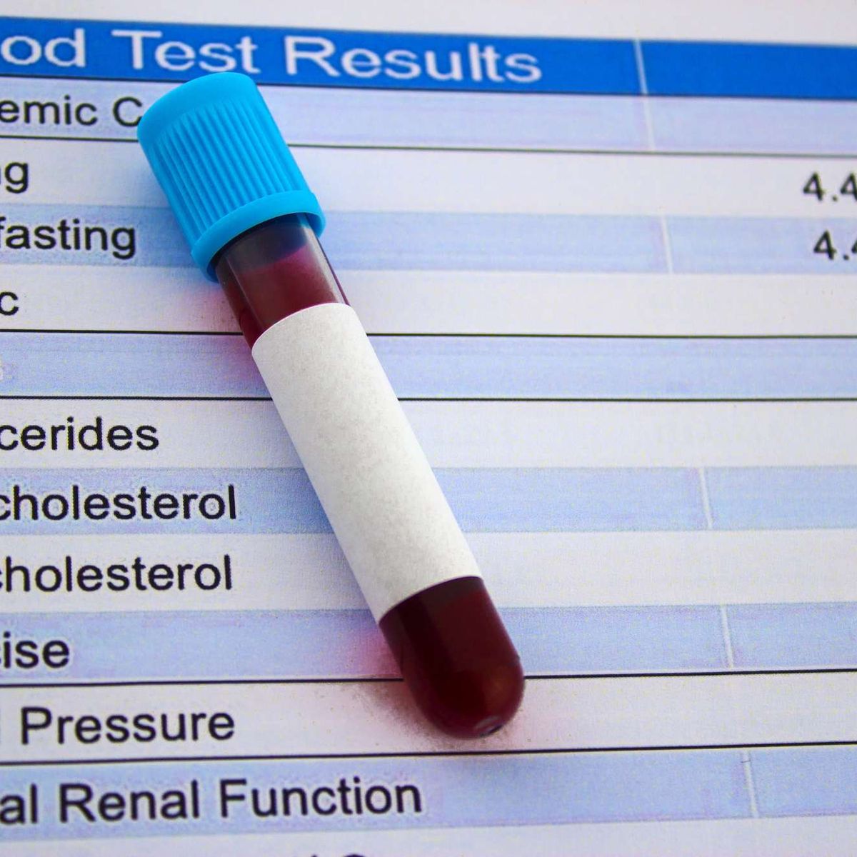 Cholesterol testing in pharmacies boosts patient access - Pharmacy Business Cholesterol testing in pharmacies boosts patient access - Pharmacy Business