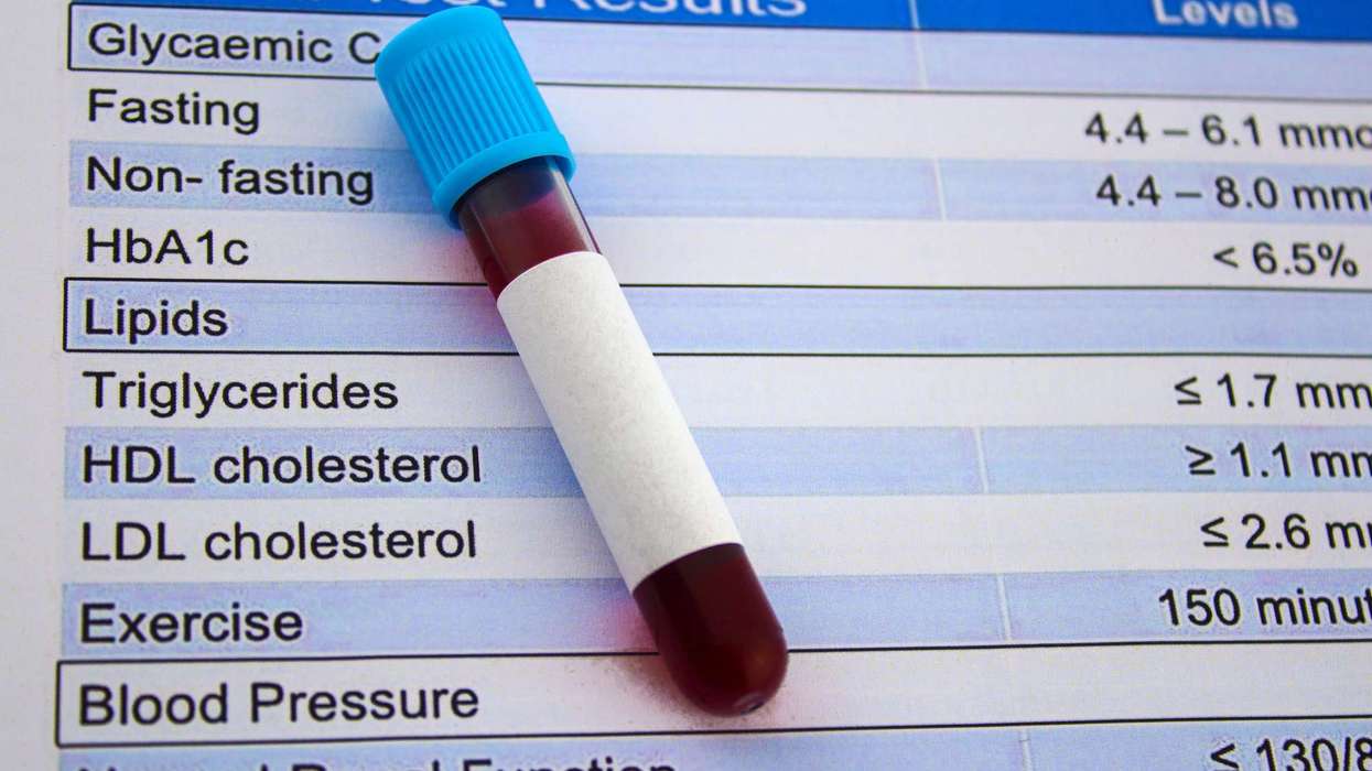 image of a blood test