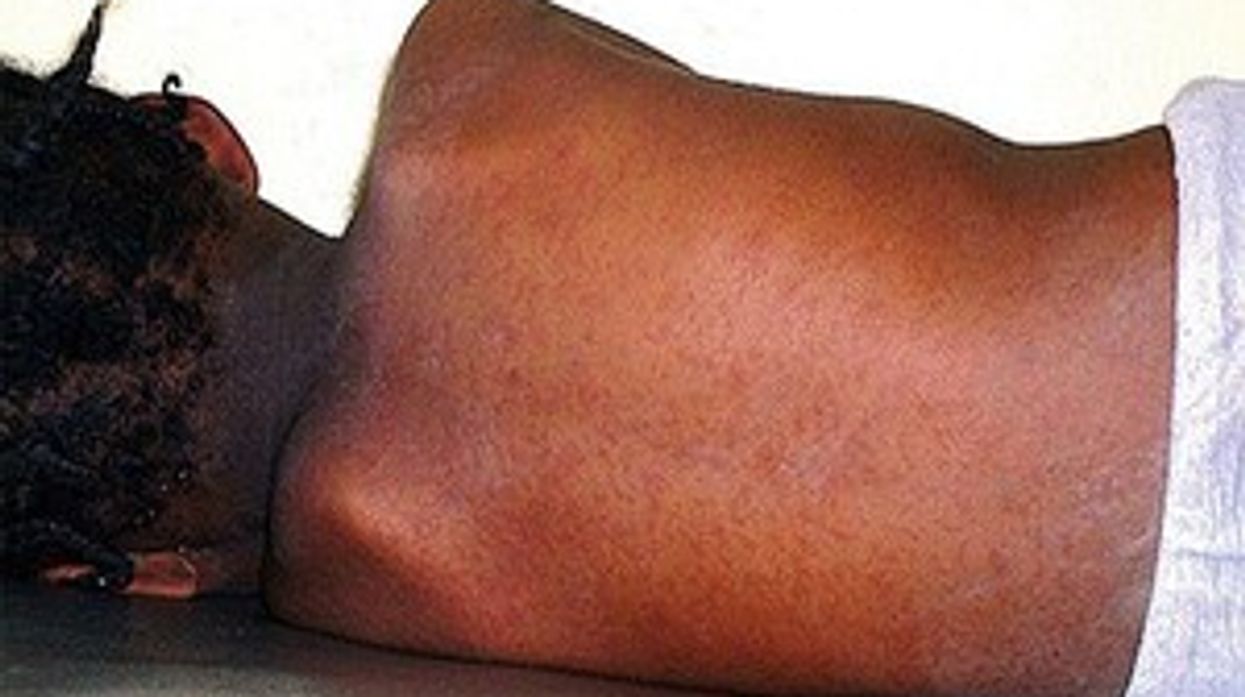 Labour Party proposes digitisation of red book to combat measles outbreaks