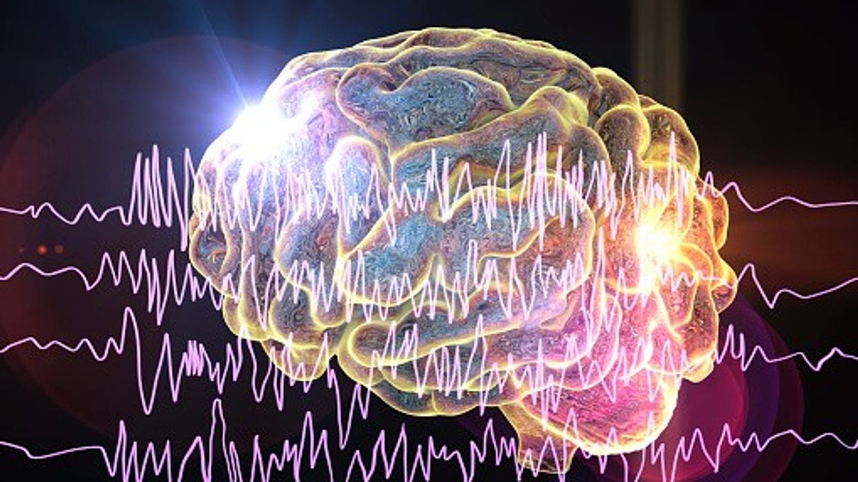 Epilepsy treatment: England to roll out new laser beam surgery next month