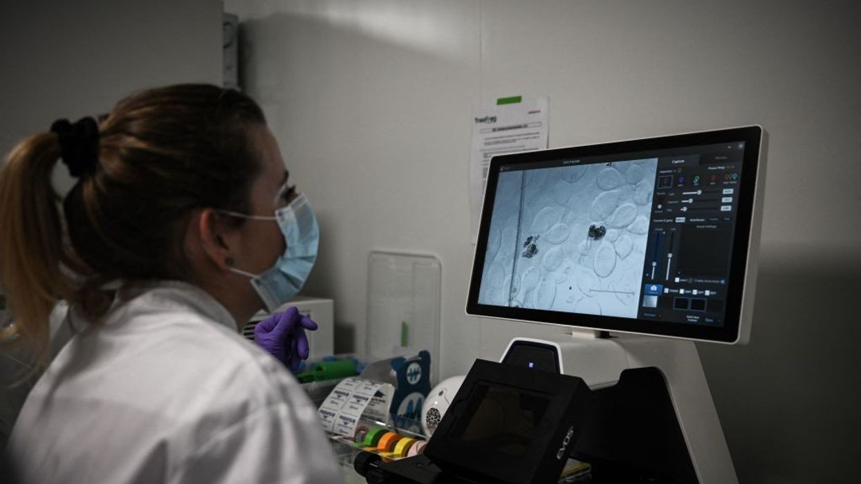 Breakthrough AI-powered blood test predicts parkinson’s 7 years before symptoms