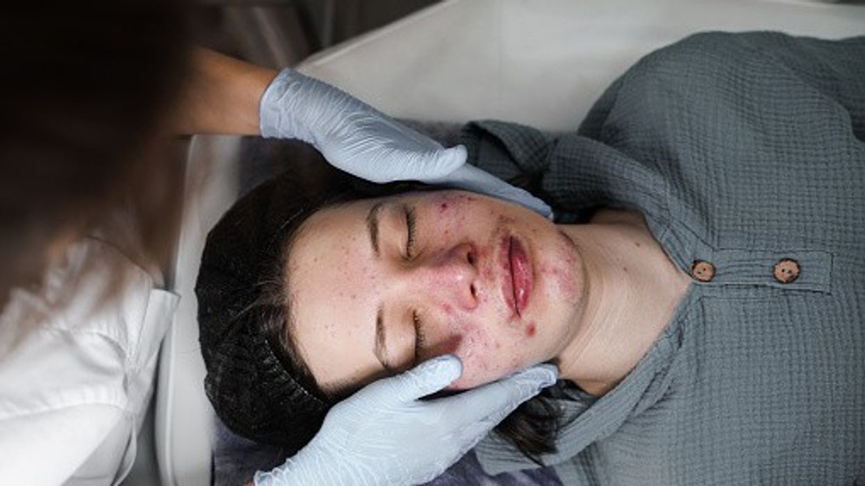 New dermatology courses for community pharmacists launched: Here’s why you should attend