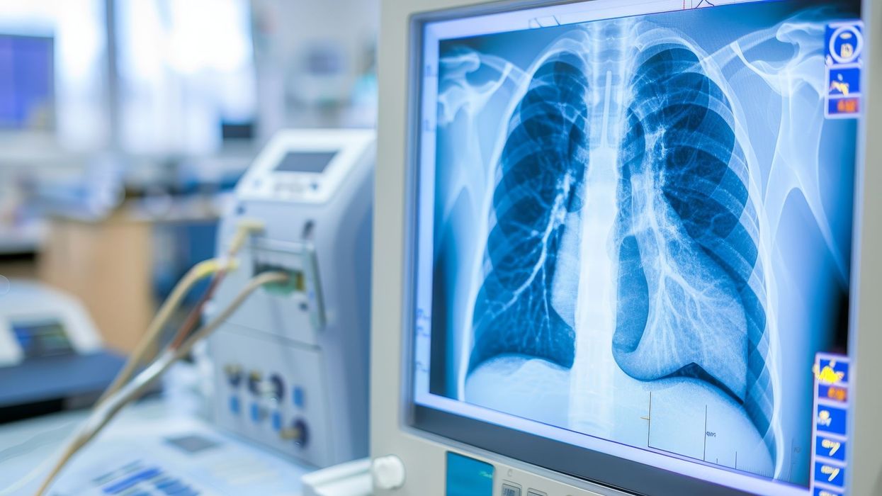 Why Healthcare Facilities Should Invest In Medical Screening Equipment