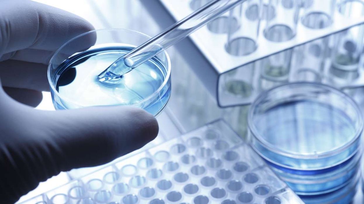 The Power of Lipid Transfection Reagents in Modern Research