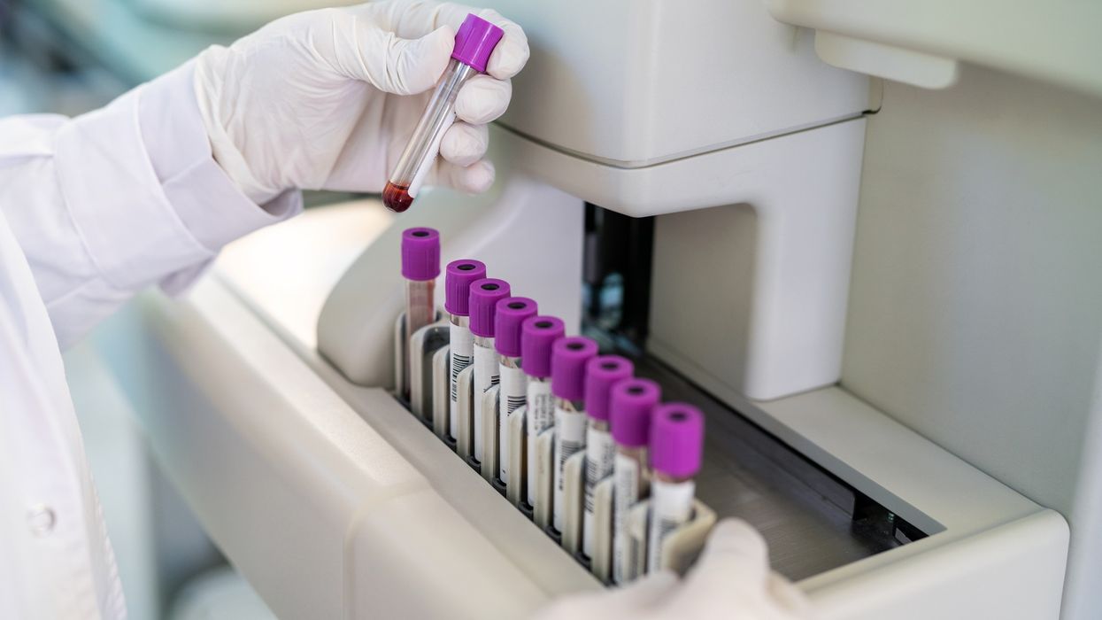 In vitro diagnostic devices