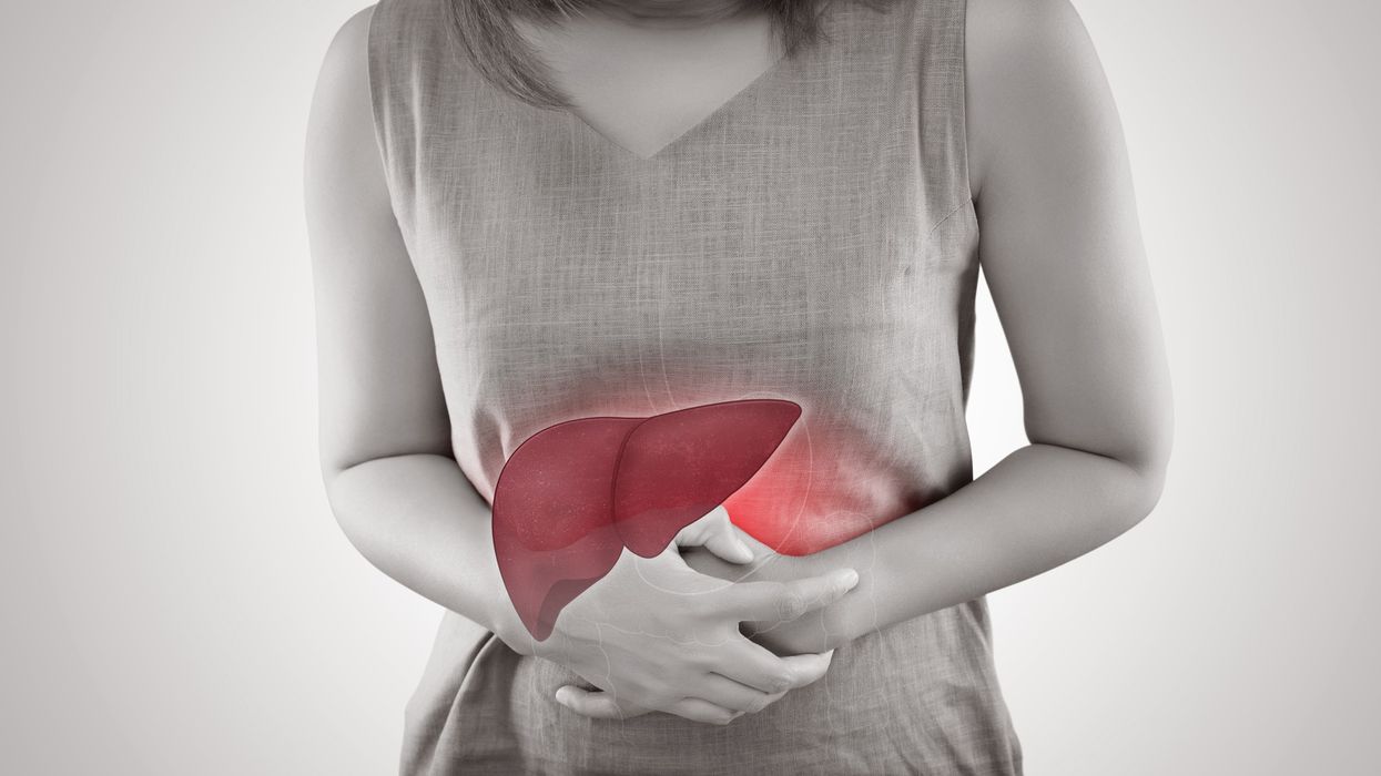 Liver cancer