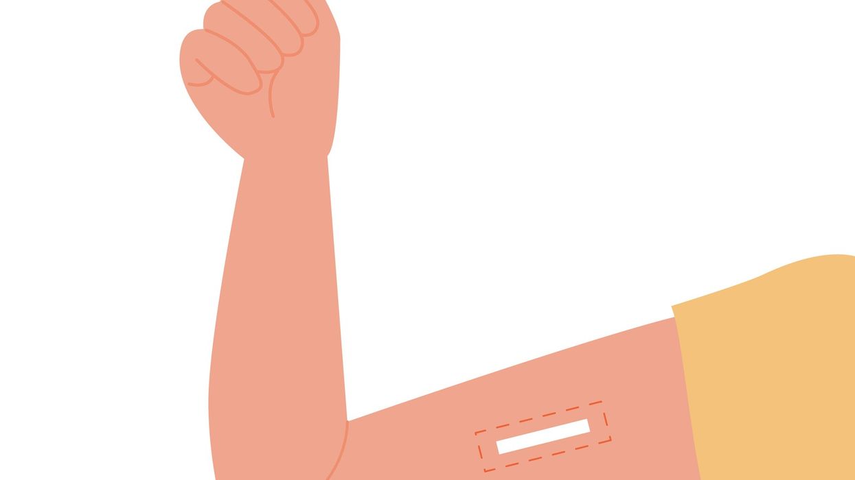 Liverpool pharmacy to pilot NHS contraceptive implant service