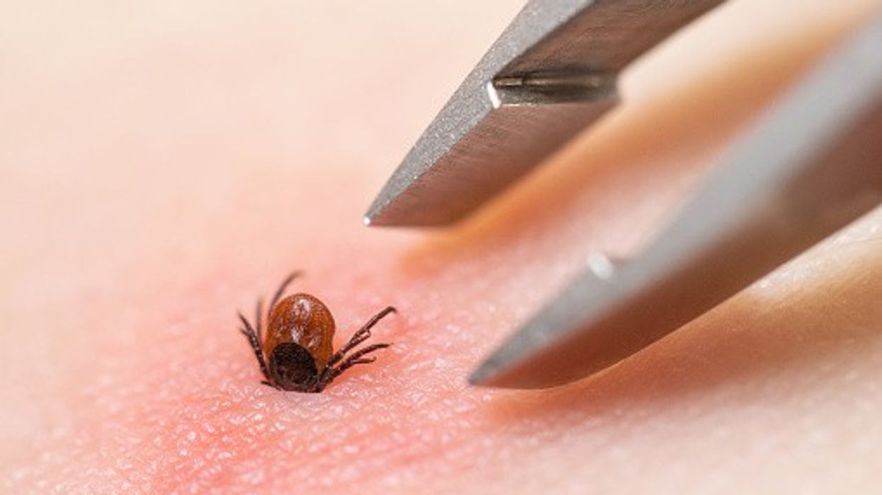 Lyme symptoms include rash, fever, fatigue, facial droop, etc.