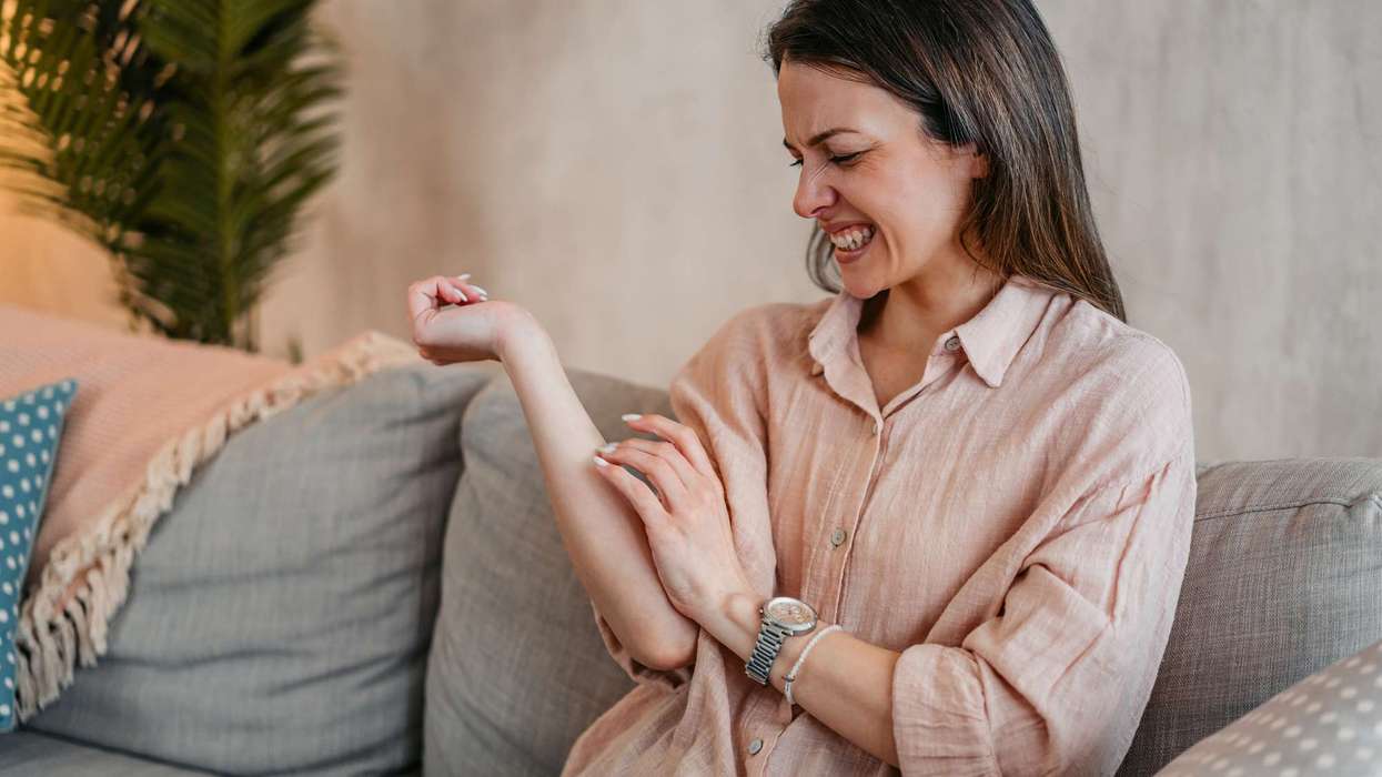 MHRA approves remibrutinib for adults with chronic spontaneous urticaria