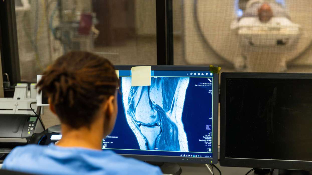 MHRA approves Romvimza to treat tenosynovial giant cell tumours