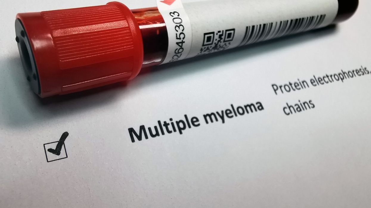 Multiple myeloma blood test