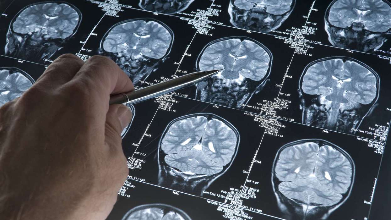 New Alzheimer’s
