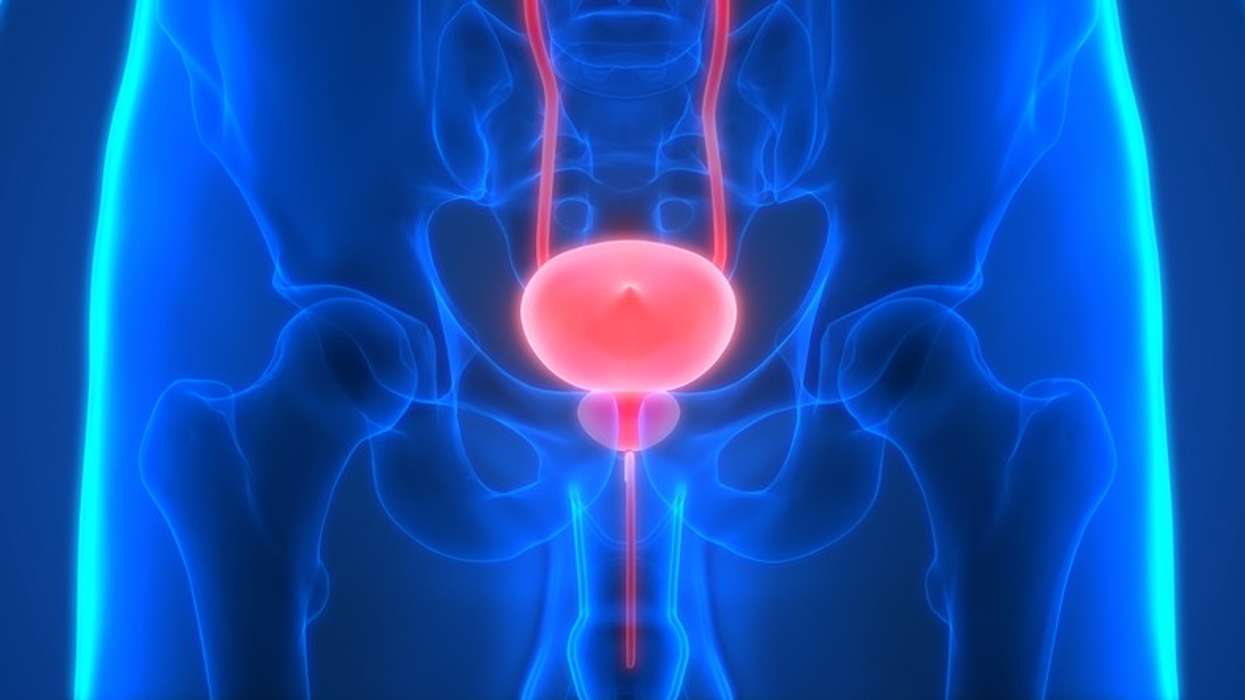 New daily pill for advanced prostate cancer to benefit thousands
