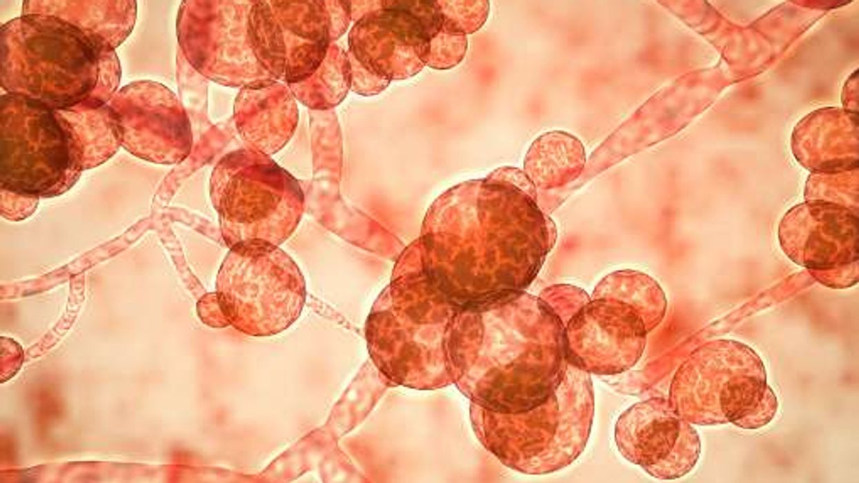 New infection in hospitals