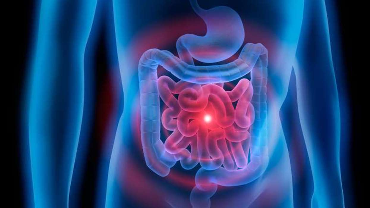 NHS bowel cancer screening helps save lives through early detection