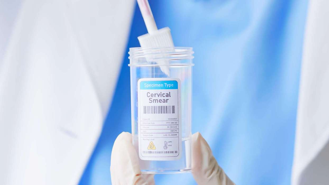 NHS rolls out home-testing kits to boost cervical cancer screening