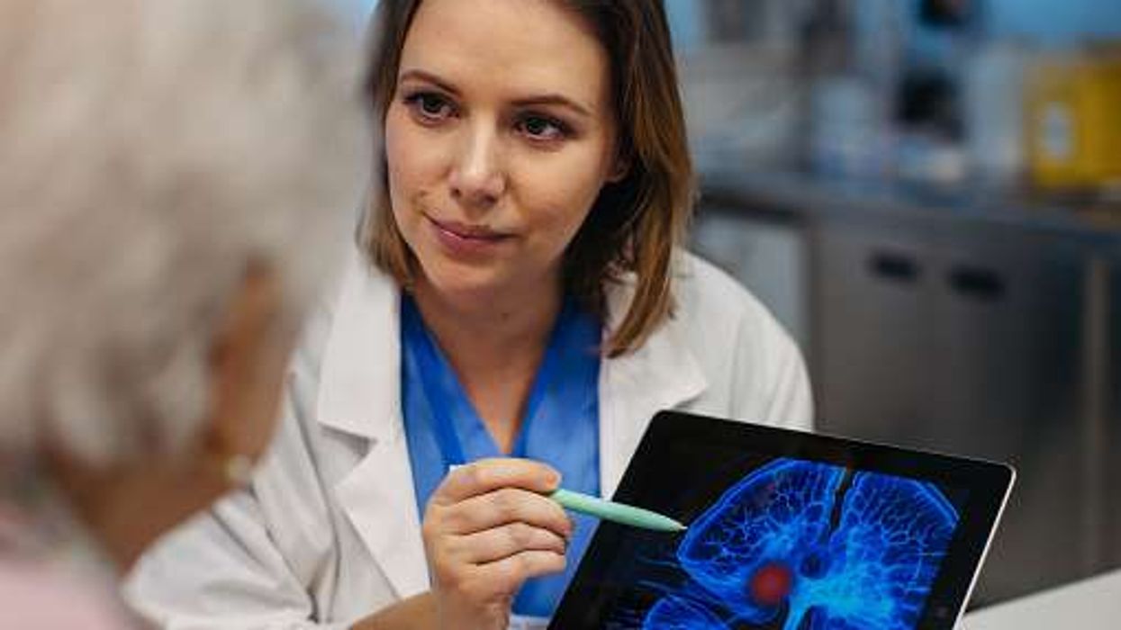 NHS stroke specialist shortage UK