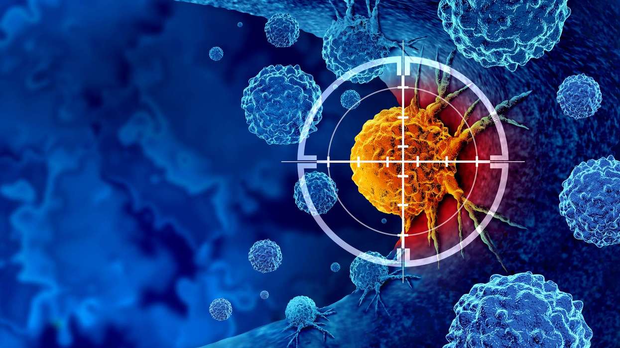 NHS’s cancer diagnosis weakening amid “systems failure”