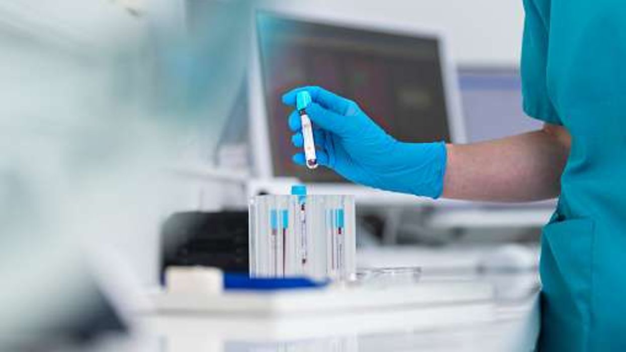 NICE backs age-based blood test thresholds to spot ovarian cancer