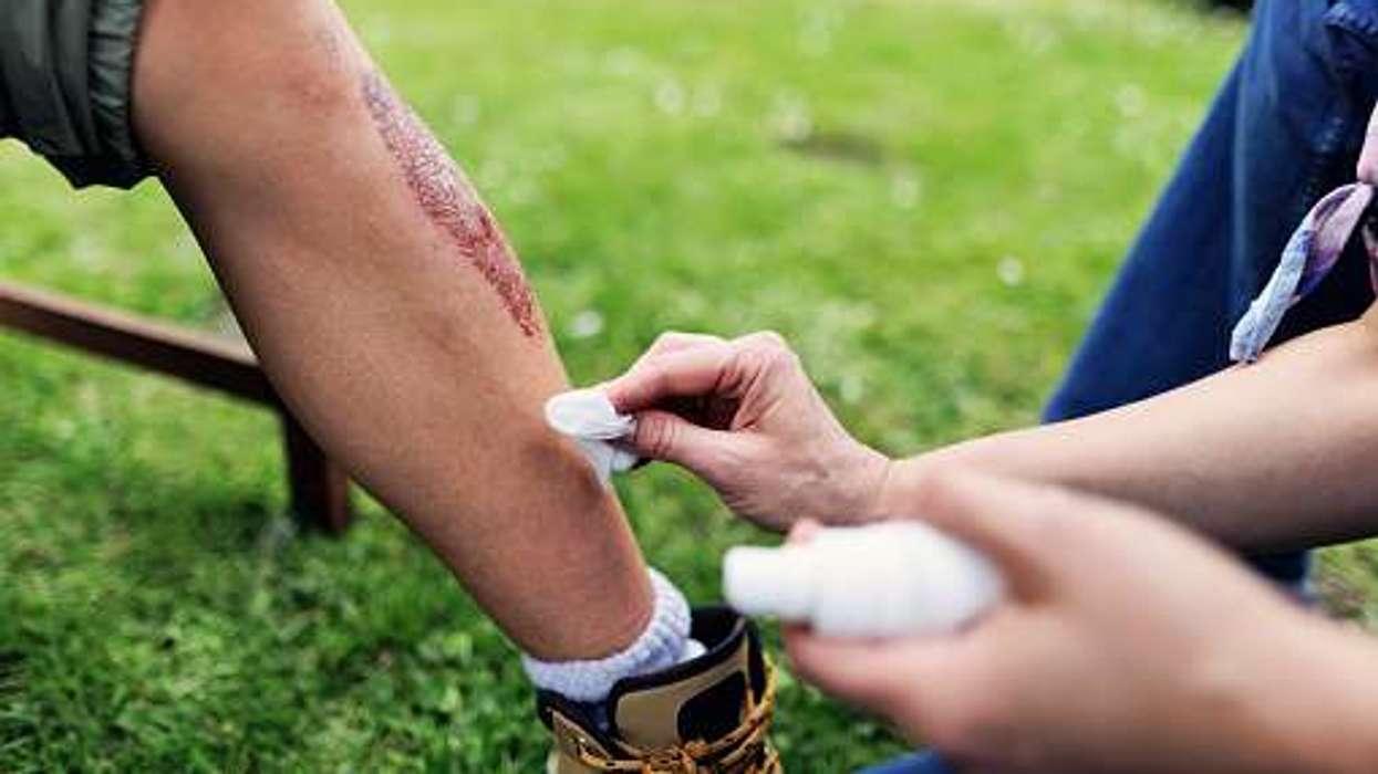 non-sterile wipes health warning