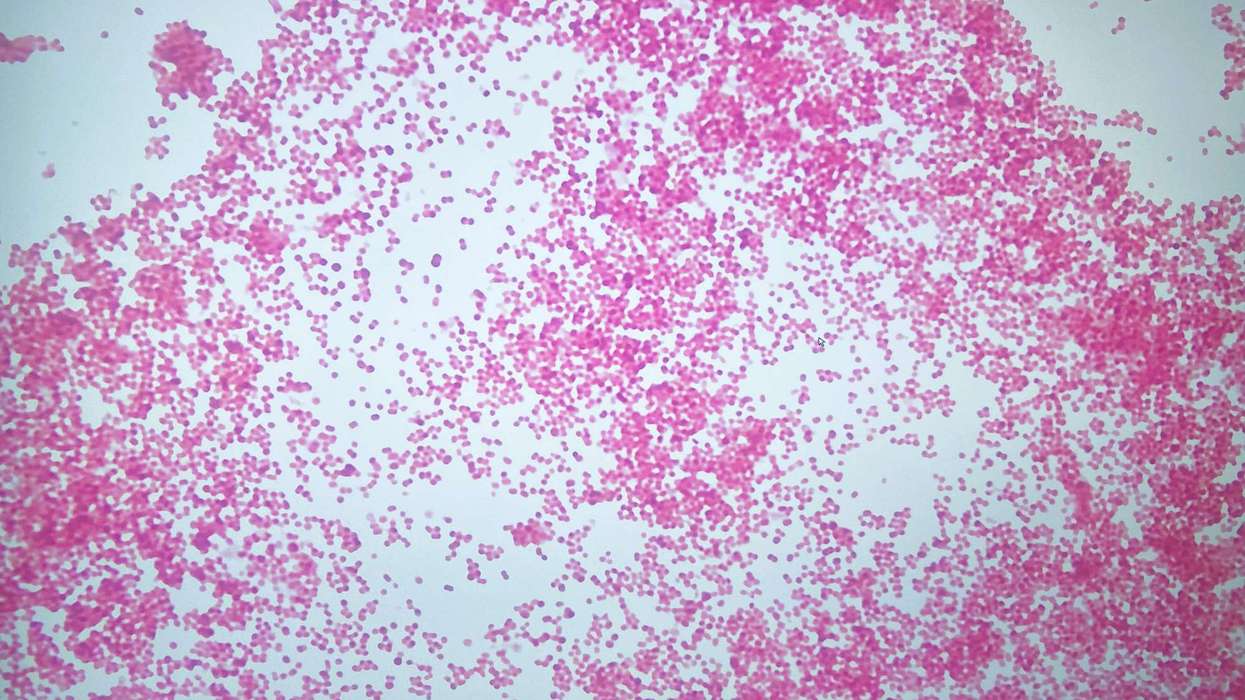 PHA reassures parents after suspected meningitis case in Belfast