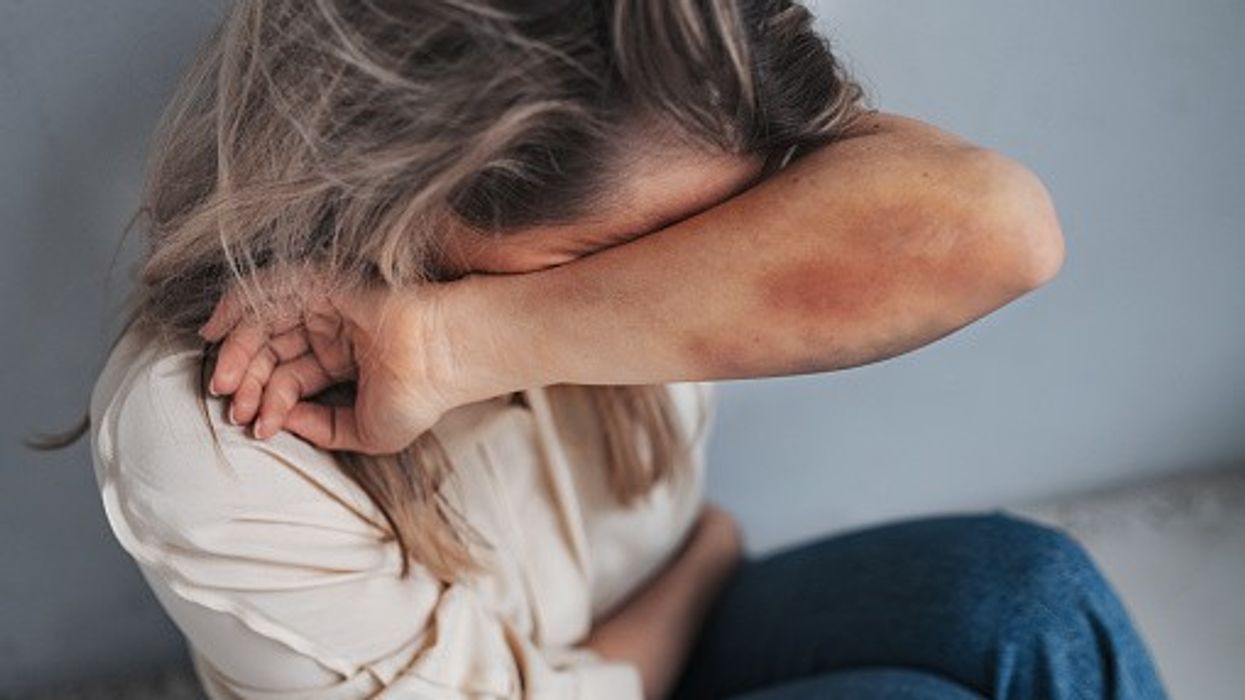 Pharmacies urged to adopt the Safe Spaces scheme to support people experiencing domestic abuse