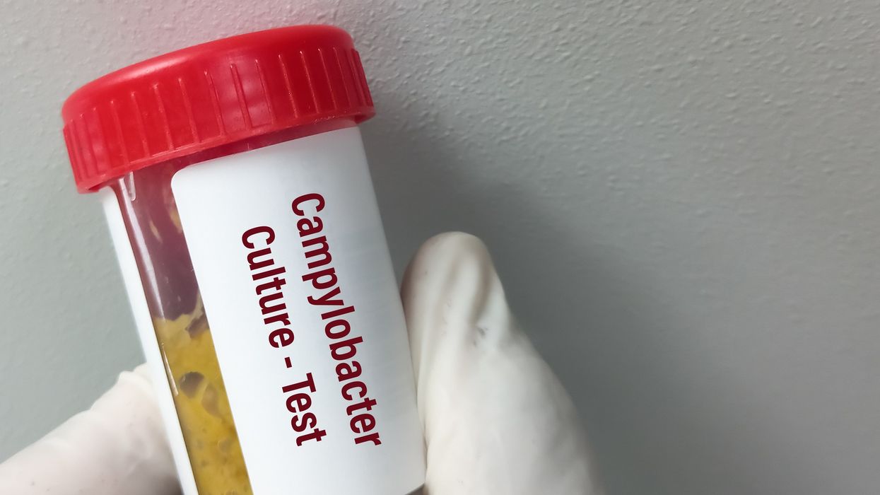 Salmonella, Campylobacter cases highest in a decade
