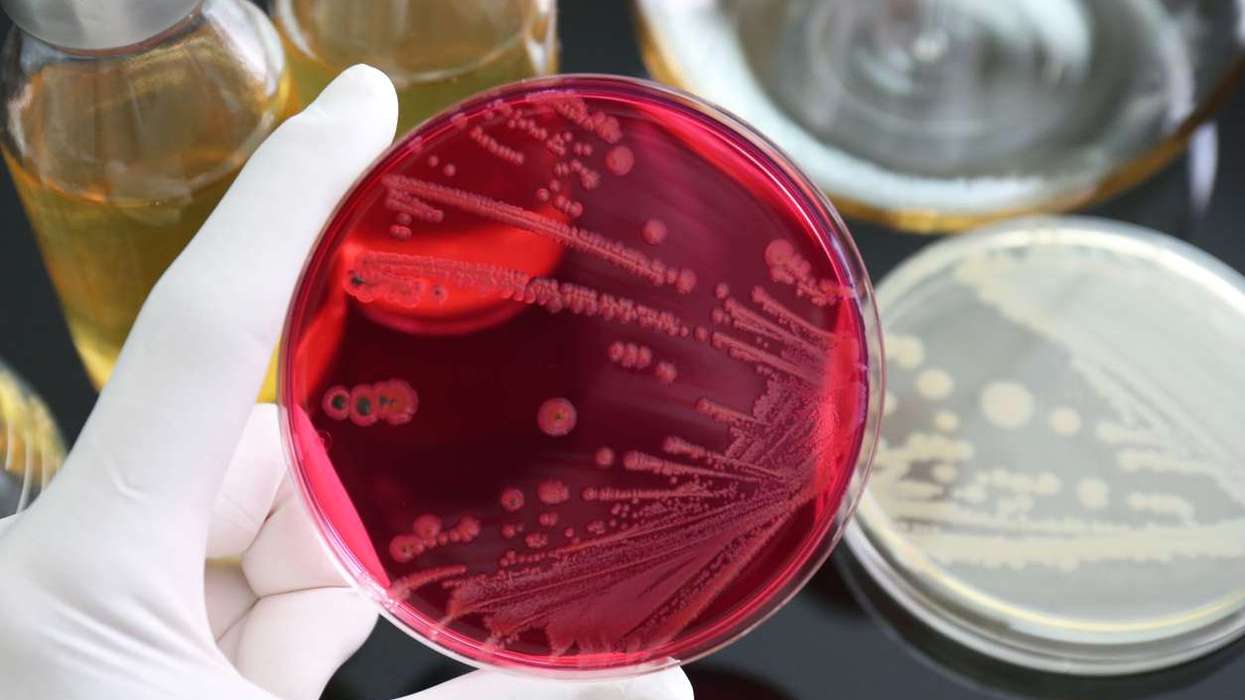 Salmonella