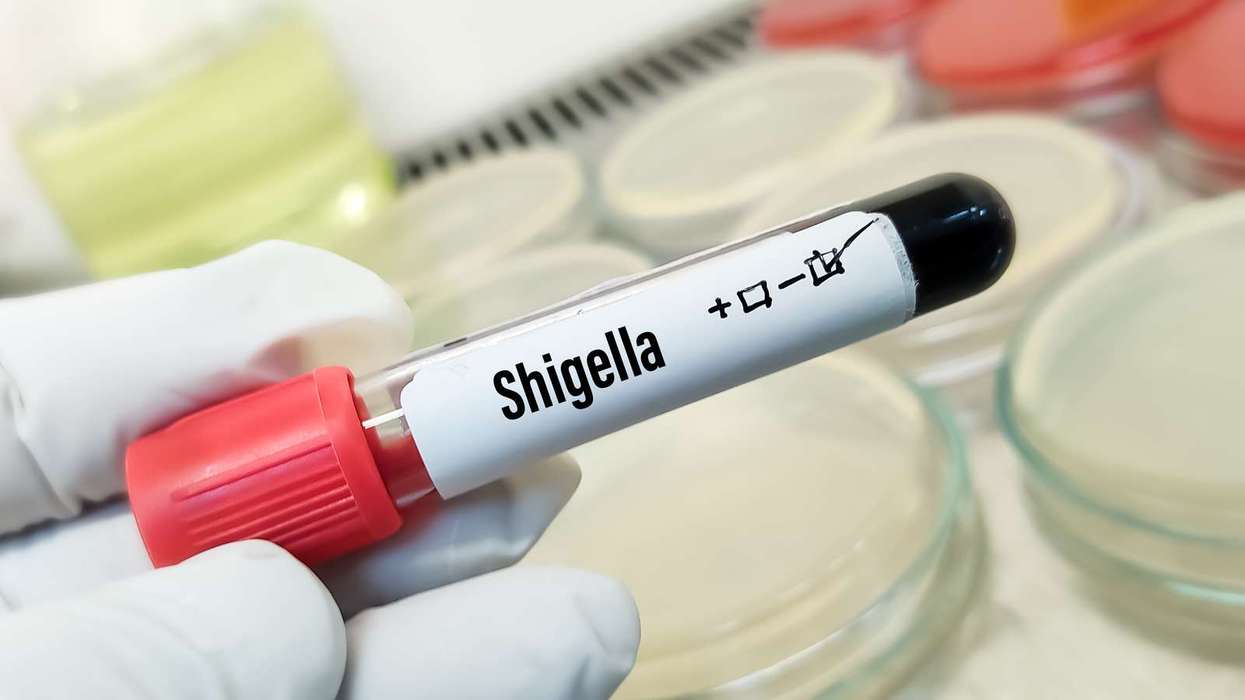 Sexually transmitted shigella cases on the rise