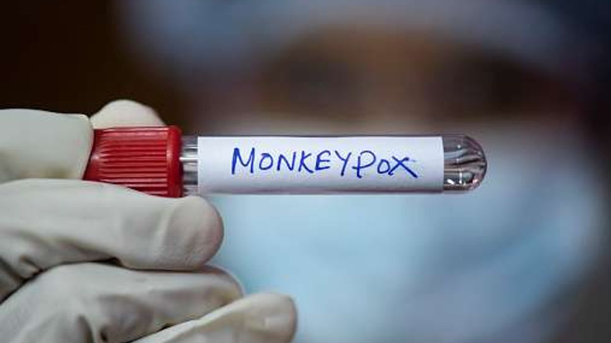 Newly evolved mpox variant found by UKHSA