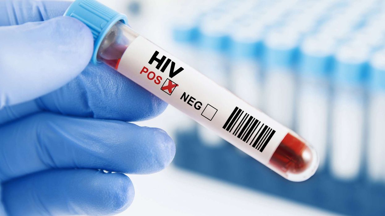 Thousands with undiagnosed hepatitis and HIV found during NHS testing