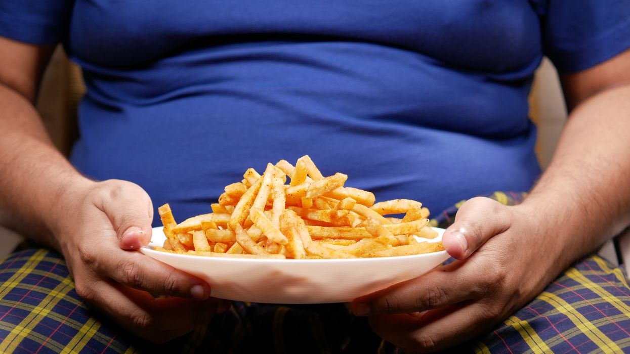 UK obesity costs