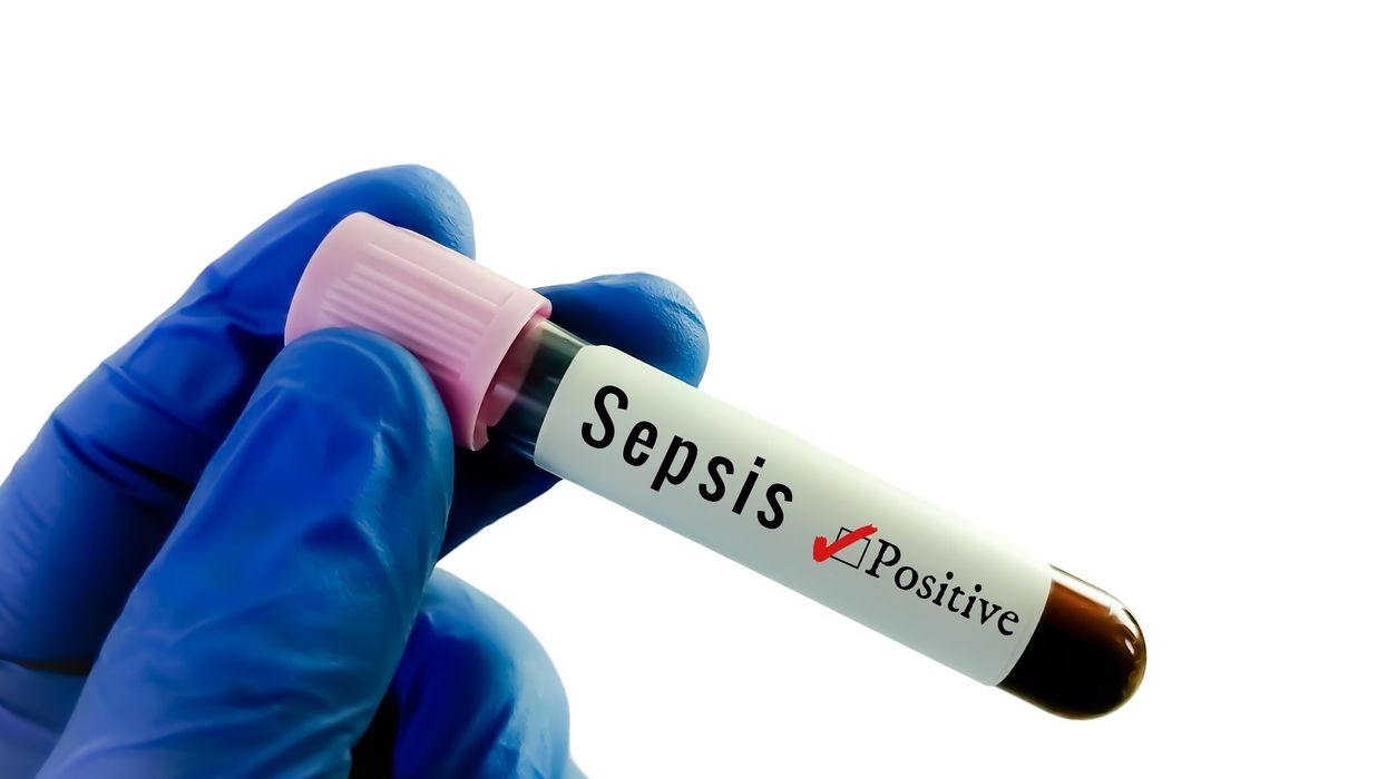 UK Sepsis Trust estimates that out of 48,000 deaths every year due to sepsis, 10,000 were avoidable.