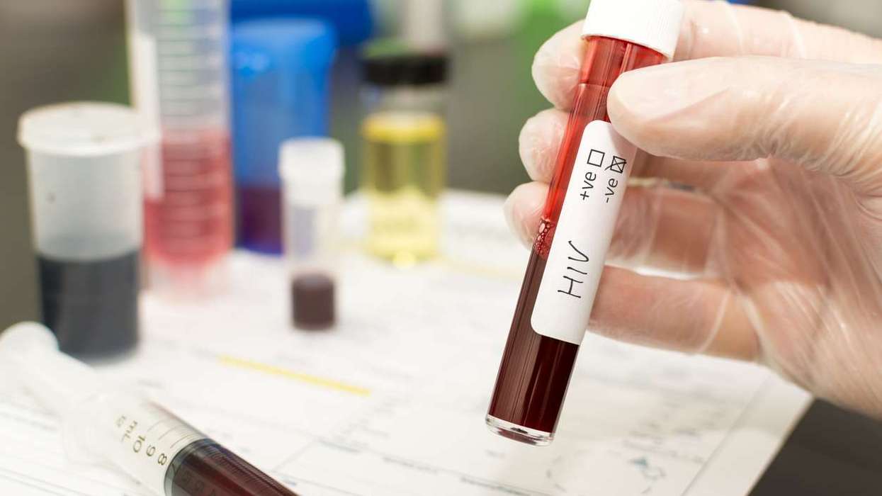 UKHSA’s HIV report shows progress but inequalities persist in England