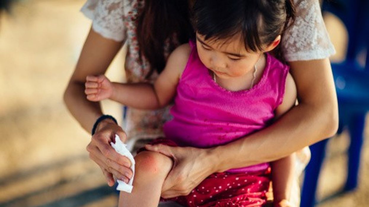 Usage of wipes that are specifically marked as ‘sterile’ on cuts or wounds are safe