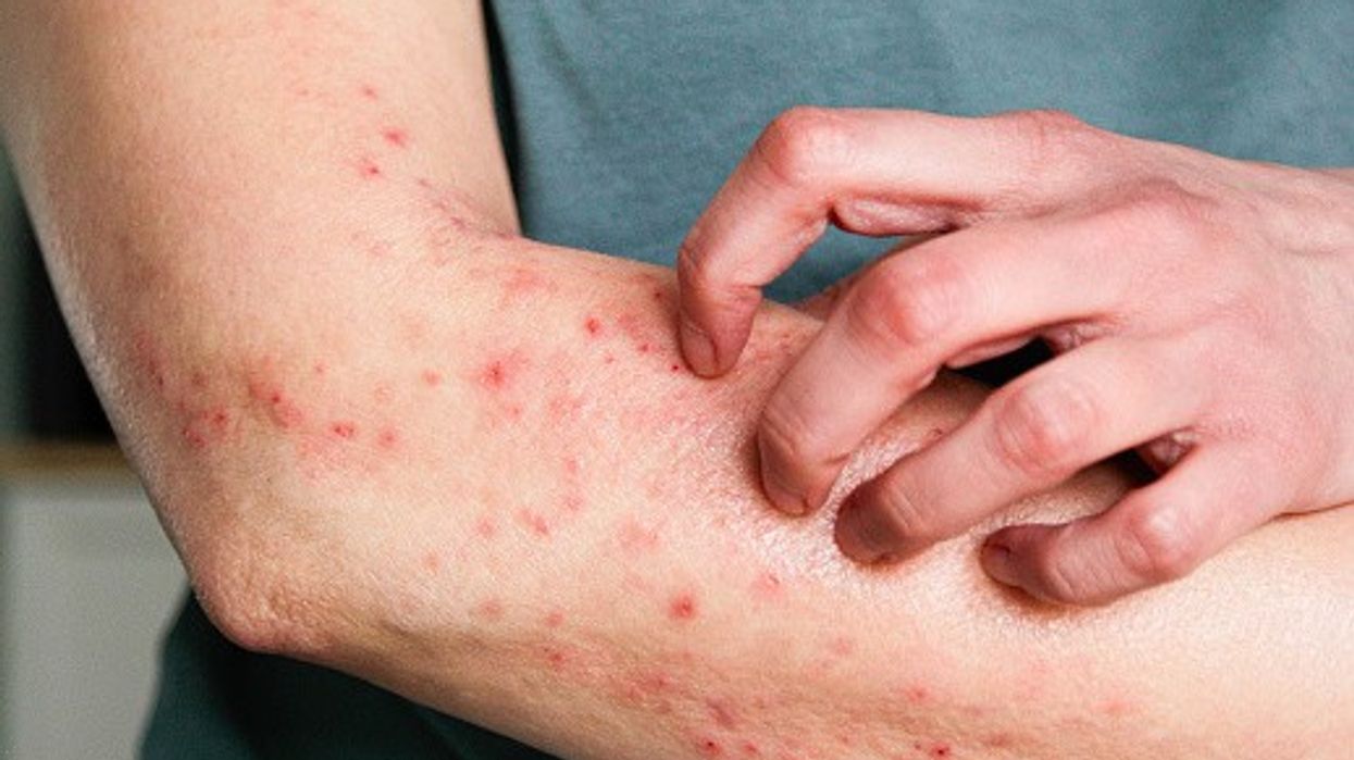 Winter skincare tips for dry skin